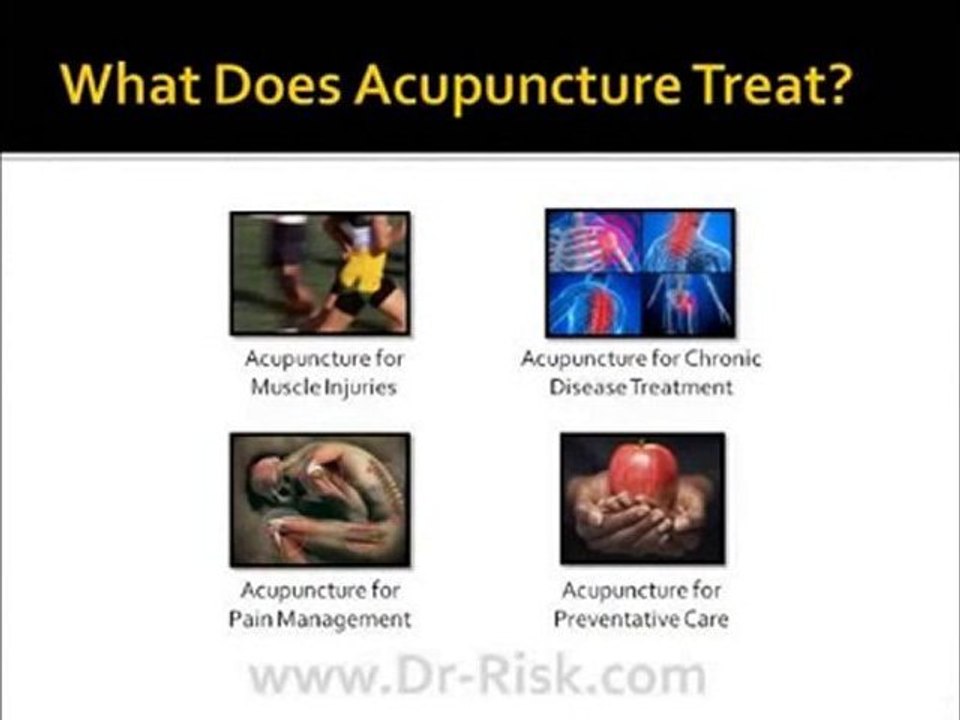 Brief Intro To Acupuncture - Dr-Risk.com