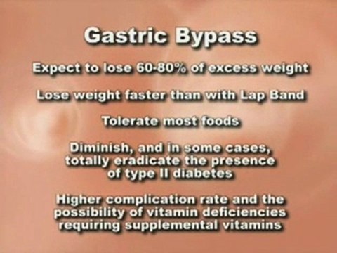 Chicago Weight Loss Surgery Procedures – Suburban Surgical