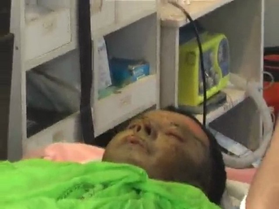 is kazasi iki yarali