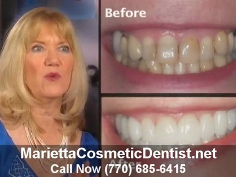 Marietta Cosmetic Dentist