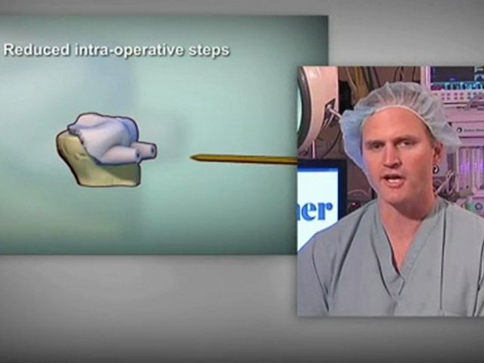 Simplified Knee Surgery with Patient Specific Instruments