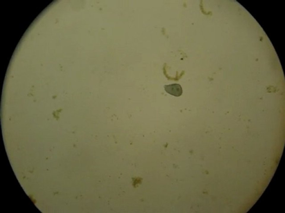 Stentor-limace