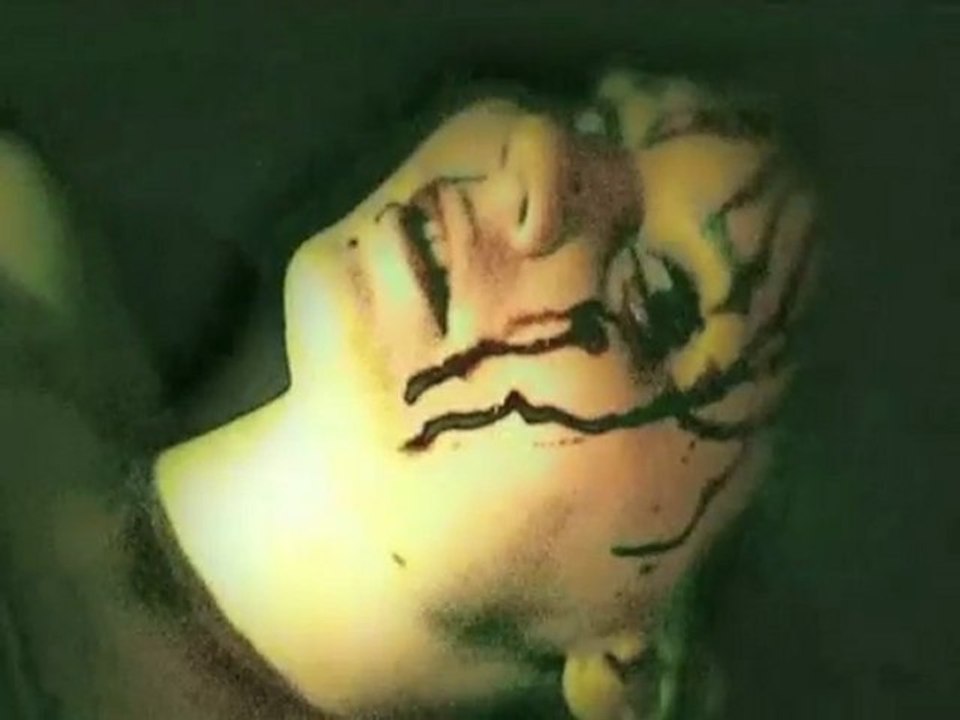Dementium The Ward - Making-Off
