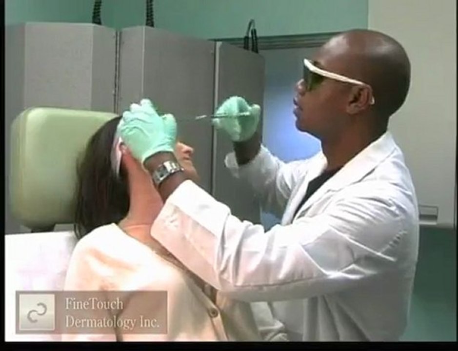 Los Angeles Botox: Elimination of Upper Face Wrinkles