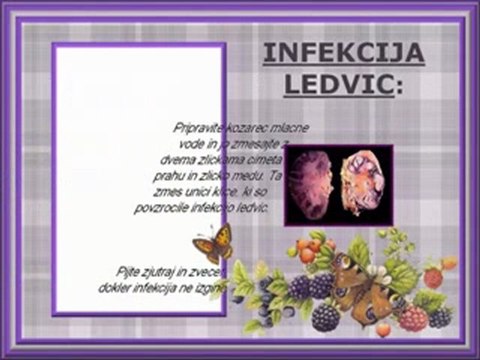 MAKSIM MRVICA the fight of the bumble bee