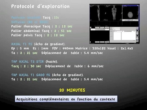 IRM corps entier - intérêt du TIMCT ONCO