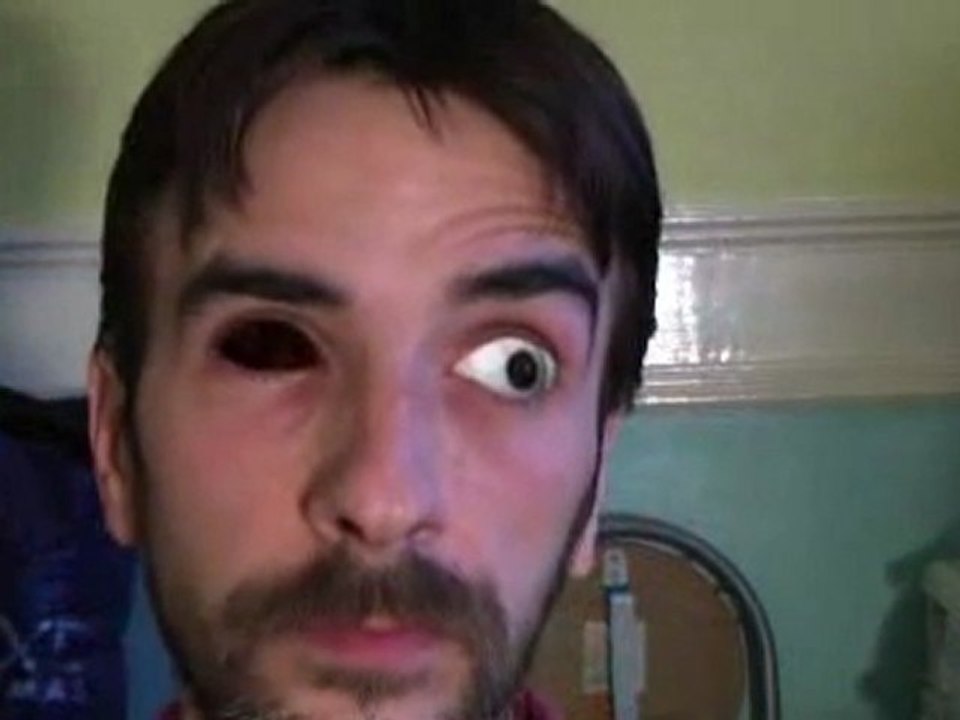 Eyeball Trick