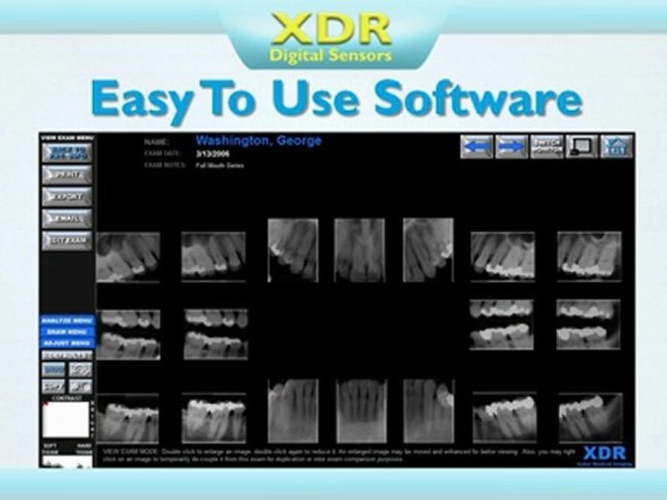 XDR Digital X-Ray Systems from www.DentalSensors.com