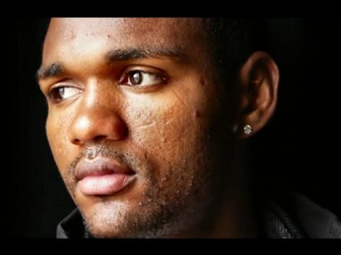 seconde partie du diaporama classe d'accuil du lycée Antoine