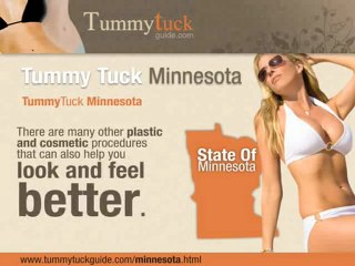 Tummy Tuck Minnesota