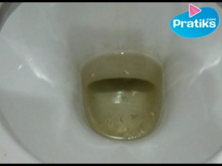 Cómo limpiar un inodoro calcificado