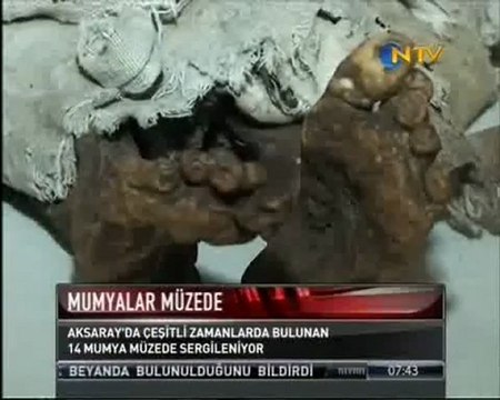 Aksaray - Ortaköy Mumya Operasyonu