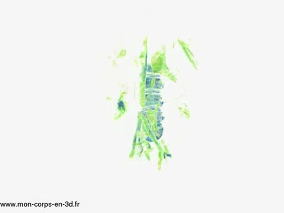 Artères abdominales et vertèbres lombaires