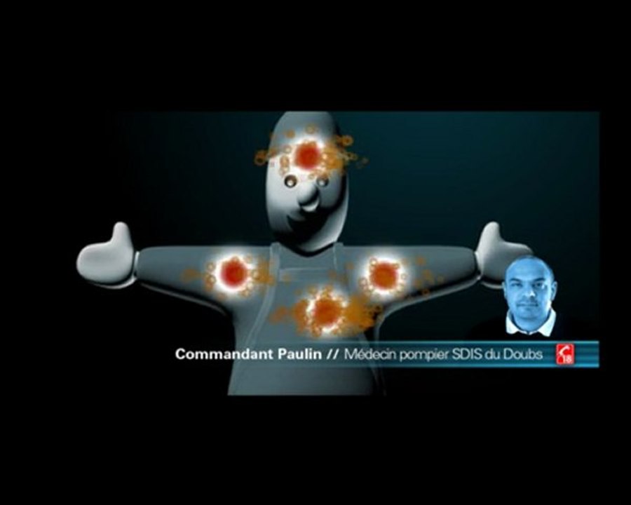 Effet antigarrot - Harnais IZI - PMS Industrie