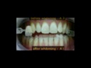 Make your teeth as white as they can Be