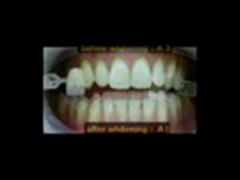 Make your teeth as white as they can Be