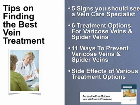 Varicose Veins – Its Causes And Treatments