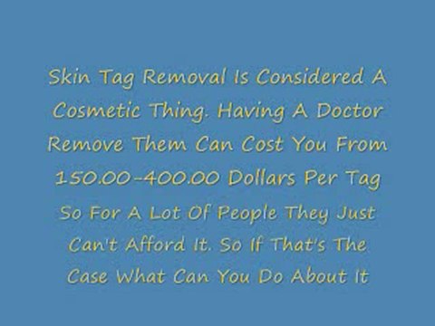 Get Rid Of Skin Tags Safe And Natural At Home
