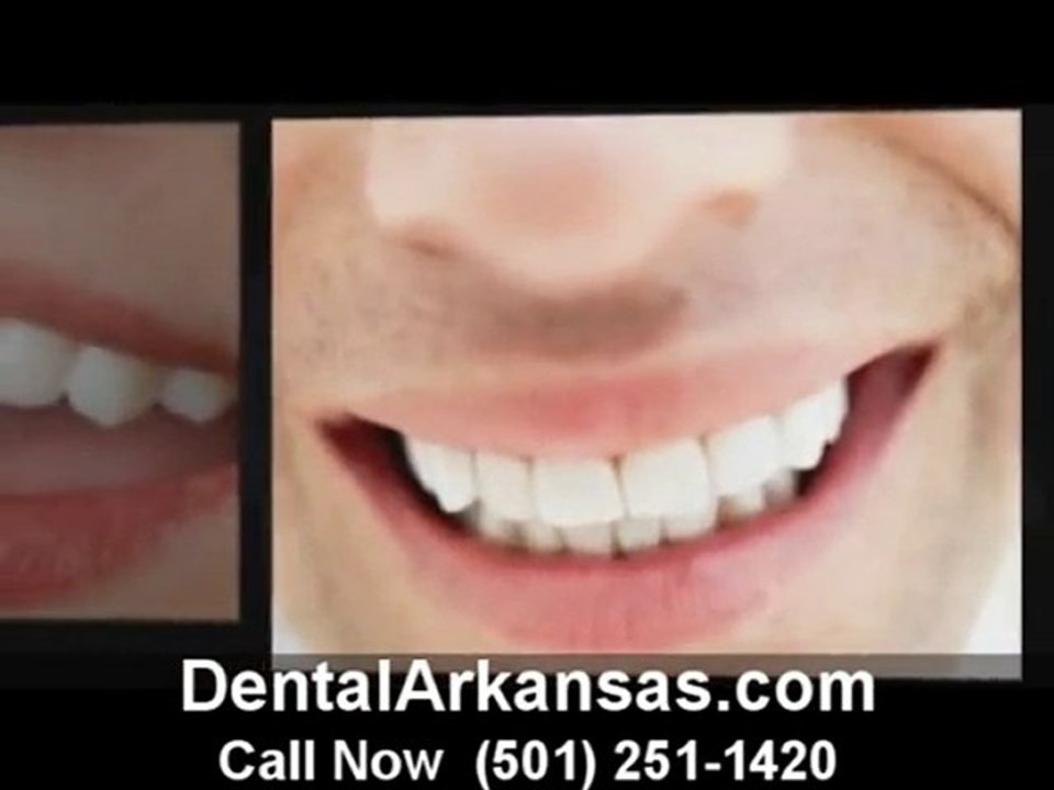 Dental Arkansas