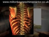 Milton Keynes Chiropractor - 4 Frequently Asked Questions