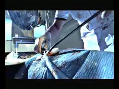 LIM SAMAT MEIDAY D MONEY EST-CE DONC CA