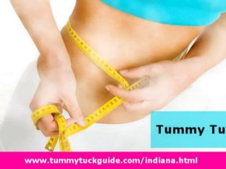 Tummy Tuck Indiana