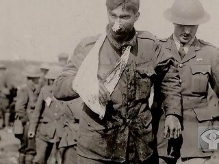 FRONT LINES - THE TRENCHES