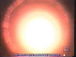 Nuclear Bomb Human Effects mini video