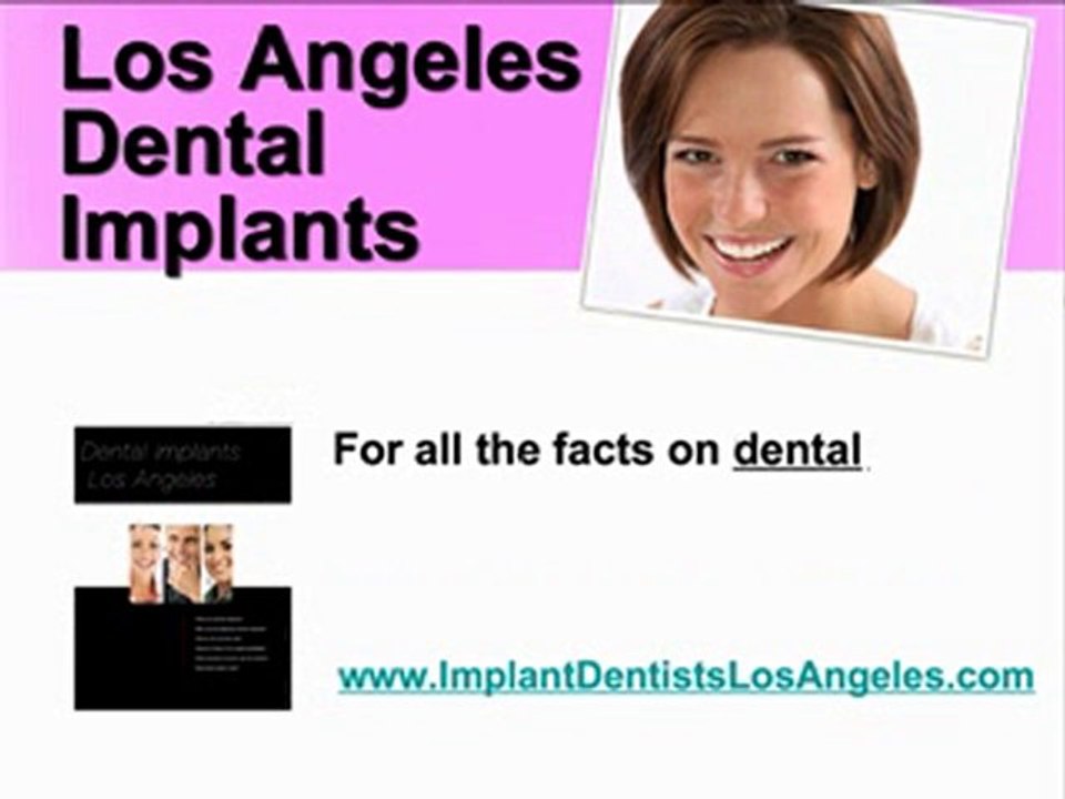 BEST LOS ANGELES DENTAL IMPLANTS