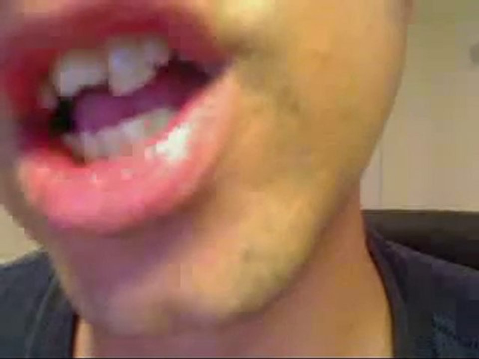 Bronx Dentist,Braces Bronx NY