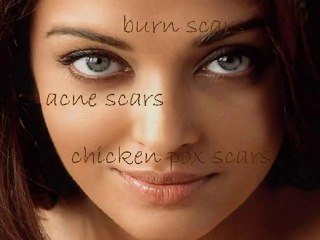 Effective & Affordable Ways to Get Rid of Scars Fast ✨