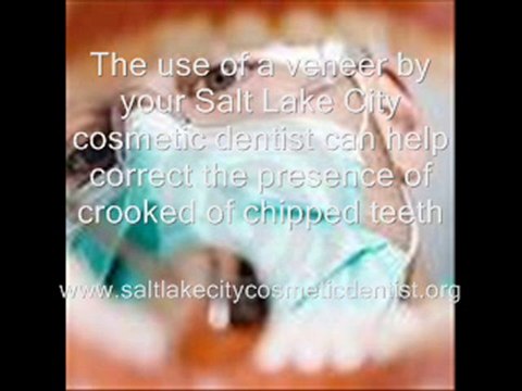 Salt Lake City Cosmetic Dentist 2