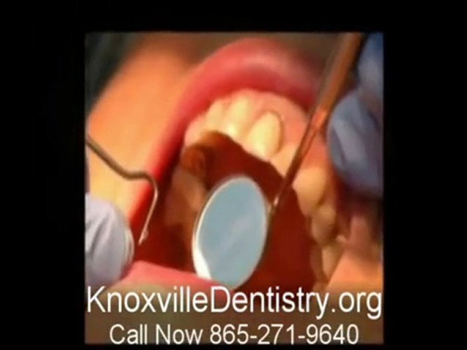 Knoxville Dentistry Services