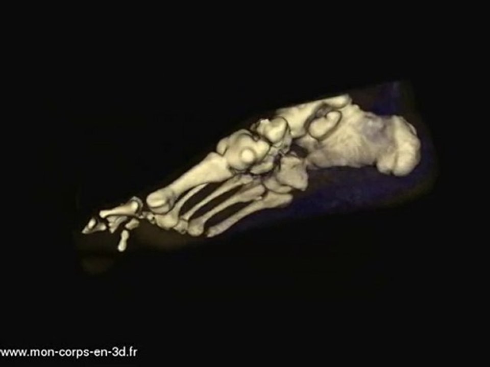 Pied en 3D