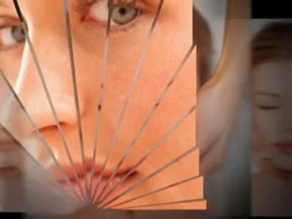 Get Rid of Spider Veins : Varicose Spider Veins