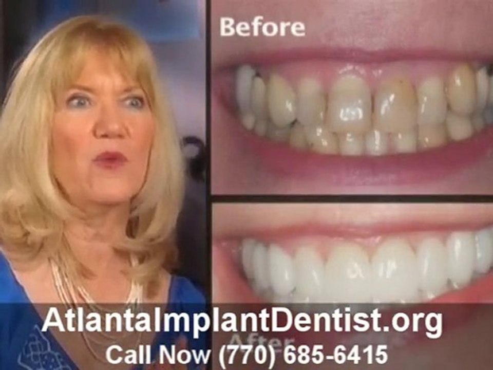 Atlanta Implant Dentist At Work