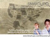 SmartLipo Wisconsin