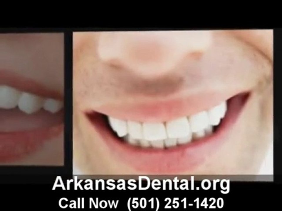 Dental Arkansas