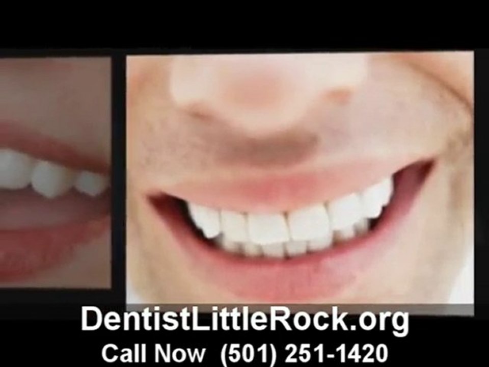 Dental Little Rock
