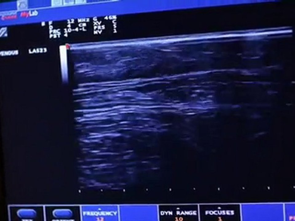 Patient Follow Up Care – Vein & Cosmetic Center Tampa Bay