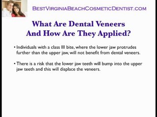 Virginia Beach Porcelain Veneers