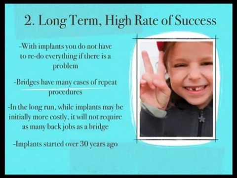 Minneapolis Dental, Bridge vs. Implant, Minneapolis Dentist