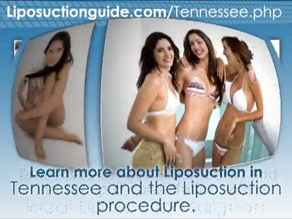 Liposuction Tennessee