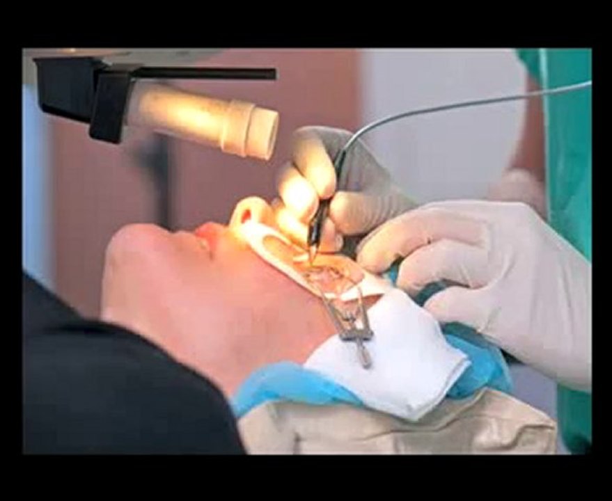 Belfast Laser Eye Surgery