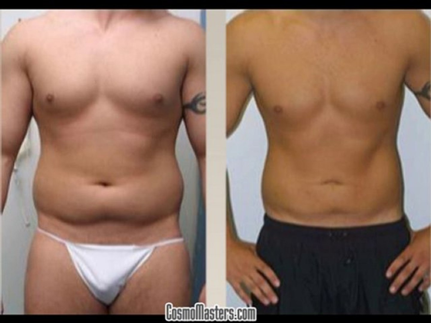 Plastic Surgery CosmoMasters®