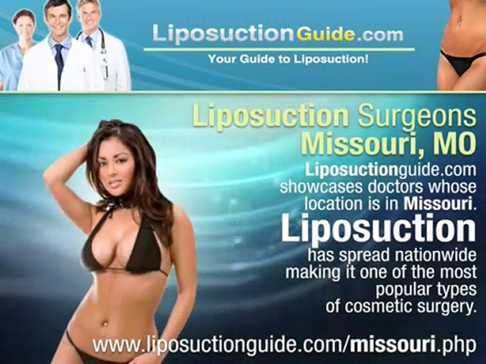 Liposuction Missouri