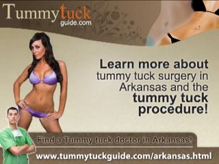 Tummy Tuck Arkansas