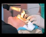 Belfast Laser Eye Surgery Clinics