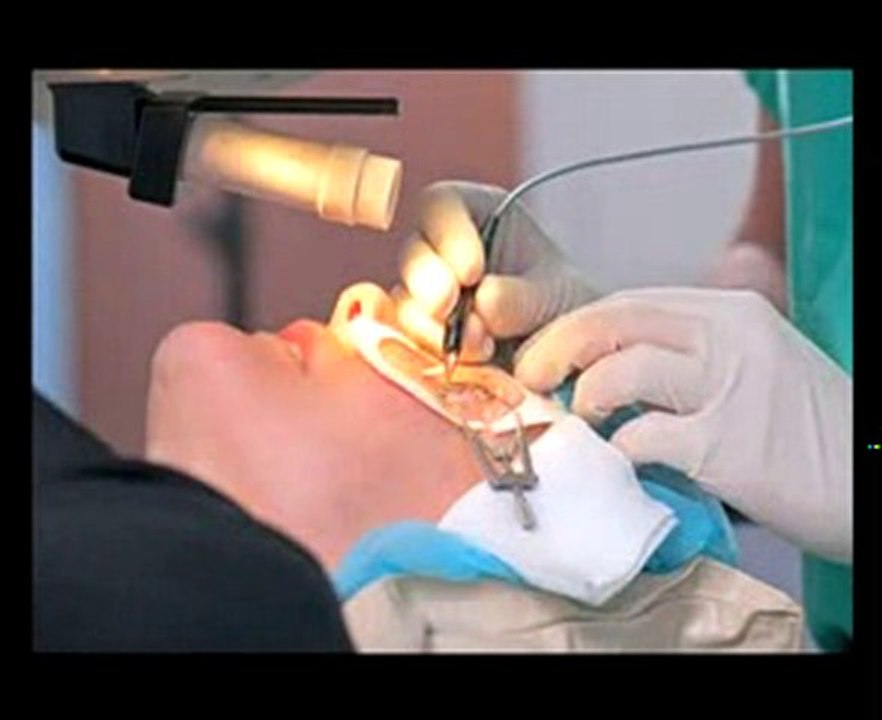 Belfast Laser Eye Surgery Clinics