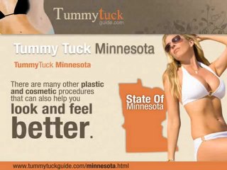Tummy Tuck Minnesota
